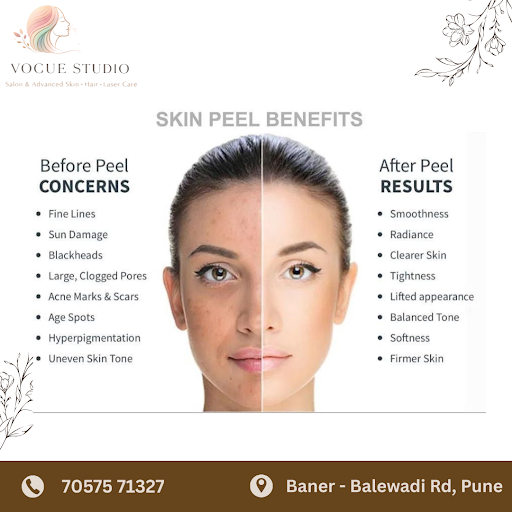 Skin Peel Benefits – How Chemical Peels Help Improve Skin Texture and Appearance