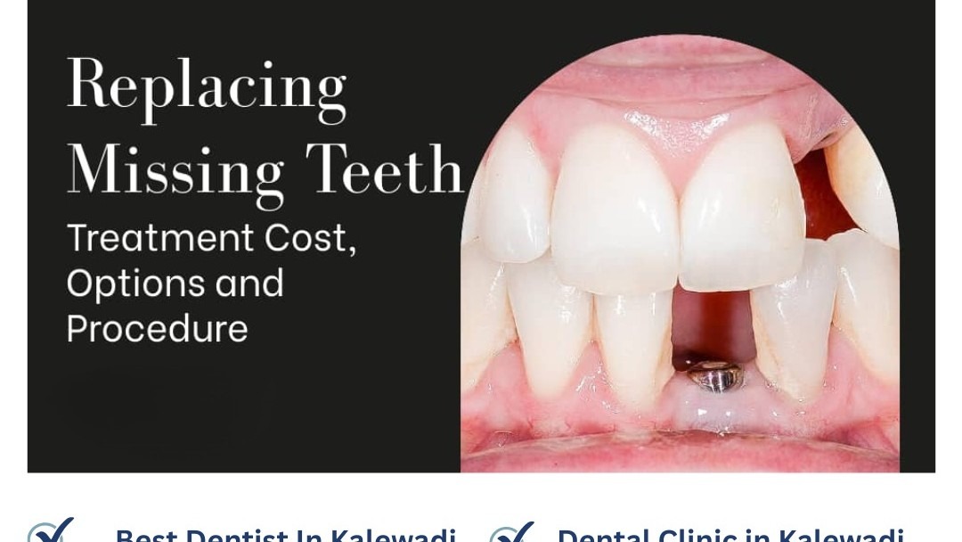 Replacing Missing Teeth: Treatment Options, Cost, and What to Expect