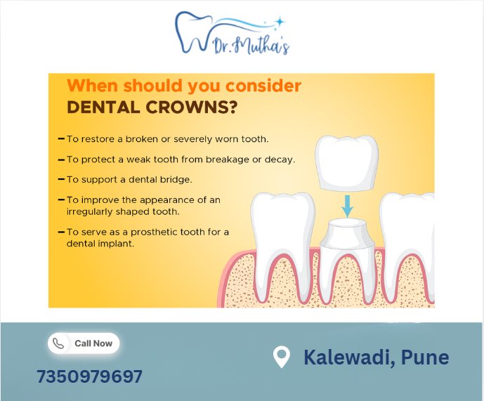 Dental Crowns for Damaged Teeth: When Are They the Right Choice?