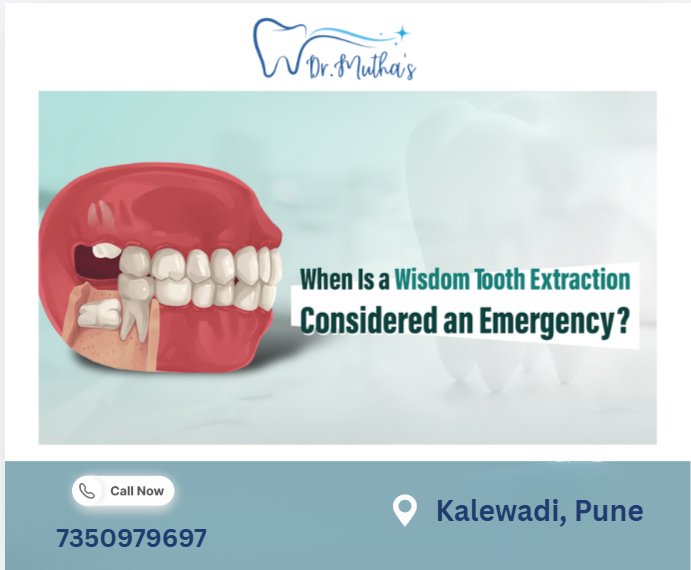 When Is a Wisdom Tooth Extraction Considered an Emergency?