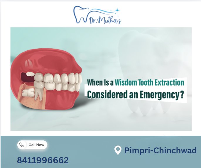 Wisdom Tooth Pain: When Is Extraction Necessary?