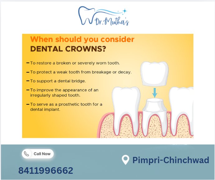 Dental Crowns: When Does a Damaged Tooth Need One?