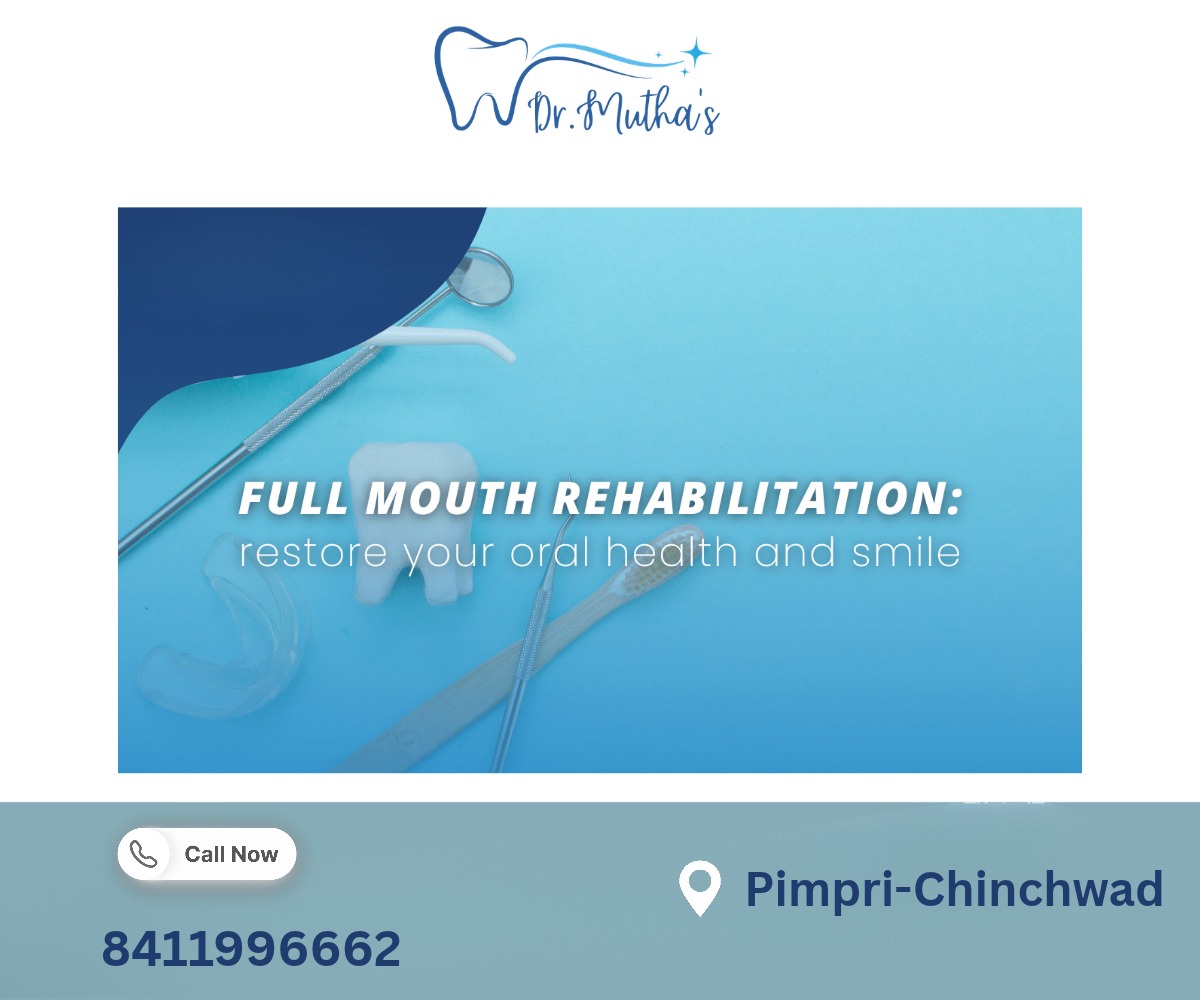 Full Mouth Rehabilitation: Understanding the Approach to Restoring Oral Function and Smile